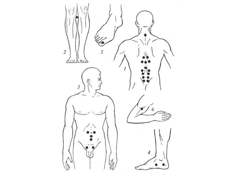 Akupunkturmassage